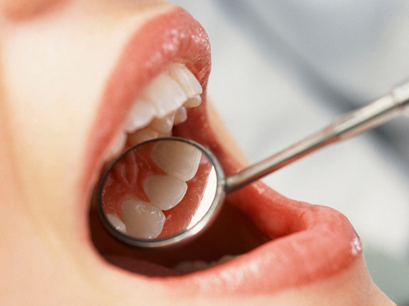 saigonimplant-35 saigonimplant-35 Nhiều bệnh nhân đã có thể phục hình hàm răng tức thì khi cấy ghép implant. KHÔI PHỤC TRẠNG THÁI TỨC THÌ CHO HÀM RĂNG KHI CẤY GHÉP IMPLANT saigonimplant 35